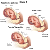 Demuestra la etapa 1 del trabajo de parto